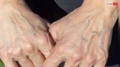 शरीर की नसें क्यों दिखती हैं नीली? जानिए इसके पीछे का दिलचस्प साइंस