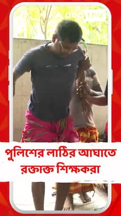 বিকাশভবনের গেট ভেঙে আন্দোলন করায়, পুলিশের লাঠির আঘাতে রক্তাক্ত শিক্ষকরা
