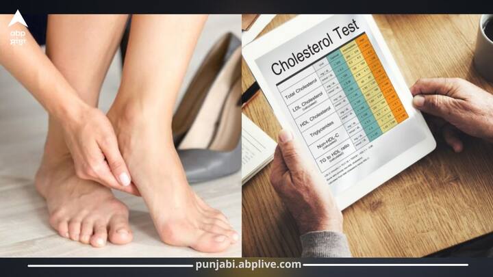 ਹਾਈ ਕੋਲੈਸਟਰੋਲ ਇੱਕ 