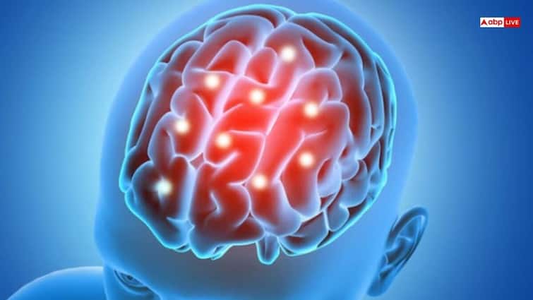 tingling on forehead symptom of brain hemorrhage know the truth माथे पर होने वाली झनझनाहट ब्रेन हैमरेज का लक्षण होता है? जान लीजिए क्या है सच