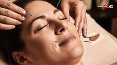 Facial Acupuncture: નાનકડી સોઇ સ્કિન ટાઇટ કરીને ખોવાયેલો ગ્લો લાવશે પરત, જાણો અન્ય ફાયદા