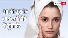 30 साल के हो गए हैं फिर भी पीछा नहीं छोड़ रहे मुंहासे? ये हो सकती है वजह