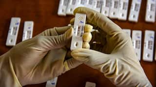 2 COVID-19 Patients Die In Mumbai Hospital, BMC Issues Statement