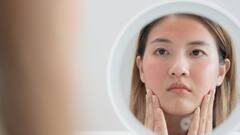 Hormonal Changes And Their Impact On Your Skin — What To Expect