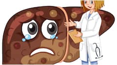 కాలేయంలో కొవ్వు ఉంటే తీసుకోవాల్సిన ఫుడ్స్ ఇవే.. లివర్​ హెల్త్ కోసం ఇవి తినేయండి