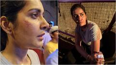 డూప్ లేకుండా స్టంట్స్ చేసిన రాశీ ఖన్నా... సెట్‌లో అందాల భామకు గాయాలు