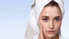 Hormonal Changes And Their Impact On Your Skin — What To Expect