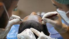 Kochi Man's Hair Transplant Goes Wrong, Clinic Owner Booked After Patient Suffers Bacterial Infection