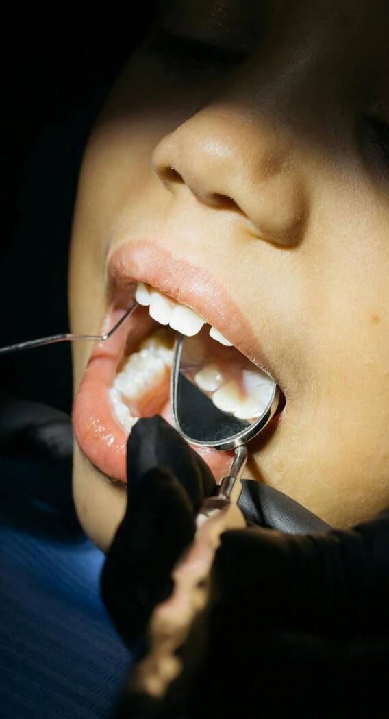 अकल दाढ़ का दिमाग से क्या है कनेक्शन?