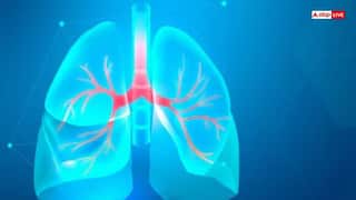 टीबी के अलावा इस बीमारी का लक्षण भी होती है लंबी खांसी, ऐसे करें पहचान