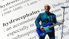 What Is Normal Pressure Hydrocephalus? Singer Billy Joel's Brain Disorder Explained