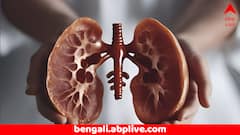 Kidney Health: কিডনিকে ফিল্টারের মত পরিস্কার করে দেয় এই ৬ ফল, তরতাজা থাকবে শরীর