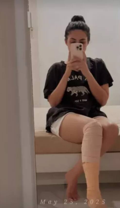 पहले जला चेहरा, अब पैर में लगी चोट, लाफ्टर शेफ में एक्ट्रेस के साथ दो बार हुआ हादसा?