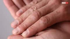 नाखून से समझें अपने लिवर का हाल, कहीं आप तो नहीं हैं बीमार