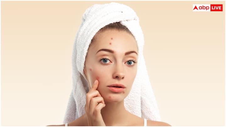 मॉनसून में नमी के कारण फंगल इंफेक्शन और स्किन से संबंधित दिक्कतें जैसे इम्पेटिगो और खुजली आम हैं. दरअसल, नमी के कारण स्किन पर बैक्टीरिया और फंगस तेजी से फैलते हैं. ऐसे में बारिश के दौरान अगर आप भीग जाएं तो तुरंत नहाएं और स्किन को सूखा रखें.