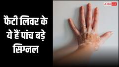 हाथों पर दिखें ये पांच लक्षण तो समझ जाएं लिवर हो गया फैटी, तुरंत जाएं डॉक्टर के पास