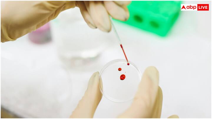 अस्पताल के सीएमओ डॉ. प्रभाकर रेड्डी ने बताया कि इस तकनीक ने 95% से अधिक सटीक नतीजे दिए हैं, जो पारंपरिक ब्लड टेस्ट के बराबर हैं. उन्होंने कहा, 'यह तकनीक उन मरीजों के लिए वरदान साबित होगी, जो सुई से डरते हैं या जिन्हें बार-बार ब्लड टेस्ट करवाने पड़ते हैं.'