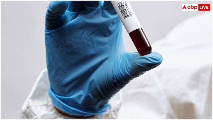 गौरतलब है कि हैदराबाद के नीलोफर अस्पताल में हाल ही में एक नई तकनीक 'अमृत स्वस्थ भारत' लॉन्च की गई. यह एआई आधारित एक डायग्नोस्टिक टूल है.