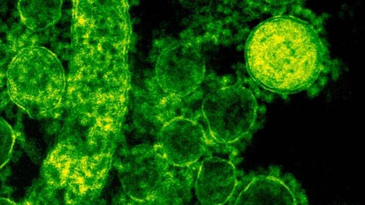 अल्फा, बीटा, डेल्टा से लेकर ओमिक्रोन तक कोरोना के वेरिएंट्स के नाम विश्व स्वास्थ्य संगठन (WHO) तय करता है. इसमें विश्व स्वास्थ्य संगठन कोविड के नए वेरिएंट्स के नाम ग्रीक अक्षरों का यूज करके रखता है जैसे अल्फा, बीटा, डेल्टा, ओमिक्रॉन.