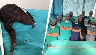 ਡਾਕਟਰਾਂ ਨੇ ਇੱਕ 14 ਸਾਲ ਦੀ ਕੁੜੀ ਦੇ ਪੇਟ 'ਚੋਂ ਕੱਢਿਆ ਵਾਲ਼ਾ ਦਾ ਸਭ ਤੋਂ ਵੱਡਾ ਗੁੱਝਾ, ਬਣ ਗਿਆ ਵਿਸ਼ਵ ਰਿਕਾਰਡ