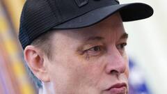 As Elon Musk’s Black Eye At White House Event Sparks Buzz, Tesla CEO Breaks Silence — Video