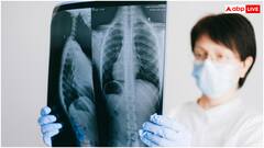 Covid 19: कोरोना से बढ़ने लगे मौतों के मामले, अब तक 28 की गई जान, बीपी-शुगर है तो हो जाएं सावधान