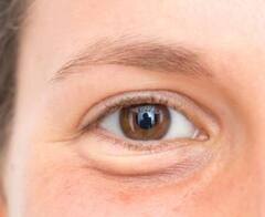 ਸਵੇਰੇ ਉੱਠਦਿਆਂ ਹੀ ਨਜ਼ਰ ਆਉਂਦੇ ਥਾਇਰਾਇਡ ਦੇ ਆਹ ਲੱਛਣ, ਭੁੱਲ ਕੇ ਵੀ ਨਾ ਕਰੋ ਨਜ਼ਰਅੰਦਾਜ਼, ਤੁਰੰਤ ਜਾਓ ਡਾਕਟਰ ਕੋਲ