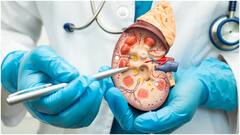 Kidney Health : కిడ్నీల ఆరోగ్యాన్ని కాపాడే ఫుడ్స్ ఇవే.. డీటాక్స్ చేయడంలో మంచి ఫలితాలుంటాయట