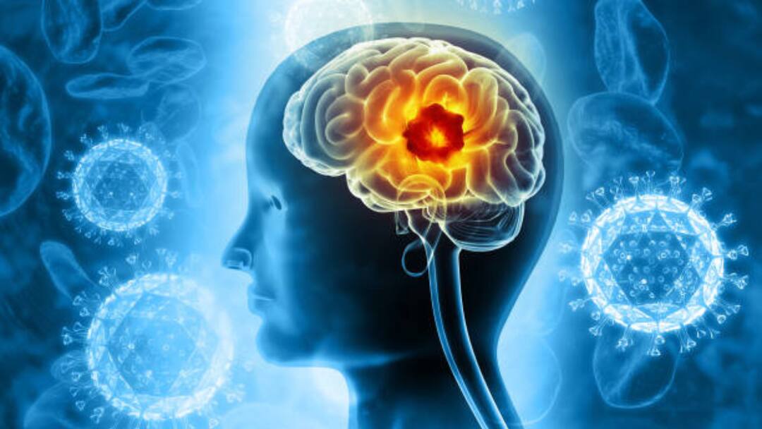 World Brain Tumor Day 2025 — Tips To Lower Brain Tumor Risk And Protect One's Health World Brain Tumor Day 2025 On 8 June Tips To Lower Brain Tumor Risk And Protect One's Health World Brain Tumor Day 2025 — Tips To Lower Brain Tumor Risk And Protect One's Health