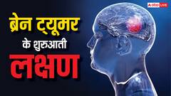 ब्रेन ट्यूमर के शुरुआती स्टेज में शरीर देने लगता है ये 6 संकेत, लक्षण दिखते ही भागें डॉक्टर के पास