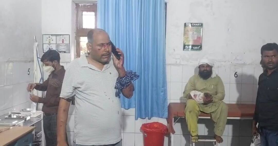 पीलीभीत में मकान में विस्फोटक ब्लास्ट आधा दर्जन लोग घायल, अस्पताल में भर्ती