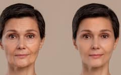 सोने से पहले बेसन के पानी से धोएं अपना चेहरा, इन 6 स्किन समस्याओं से मिलेगी राहत