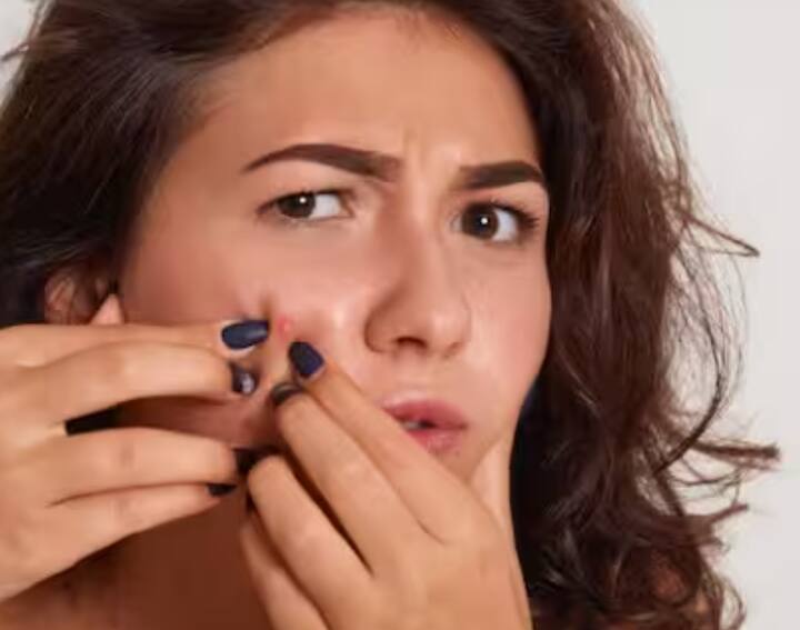 ਪਿੰਪਲਸ ਤੋਂ ਰਾਹਤ: ਬੇਸਨ ਵਿੱਚ ਮੌਜੂਦ ਐਂਟੀਬੈਕਟੀਰੀਅਲ ਗੁਣ ਚਿਹਰੇ ਤੋਂ ਐਕਸਟ੍ਰਾ ਆਇਲ ਹਟਾ ਕੇ ਪੋਰਸ ਨੂੰ ਸਾਫ ਕਰਦੇ ਹਨ। ਇਸ ਨਾਲ ਮੁਹਾਸੇ ਅਤੇ ਐਕਨੇ ਦੀ ਸਮੱਸਿਆ ਹੌਲੀ-ਹੌਲੀ ਘੱਟ ਜਾਂਦੀ ਹੈ।