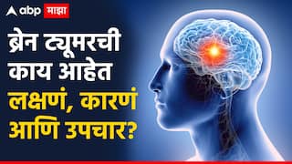 Health Tips : ब्रेन ट्यूमर समजून घेताना; काय आहेत लक्षणं, कारणं आणि उपचार? वाचा तज्ज्ञांचा सल्ला