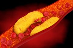 सरसों तेल सेहत के लिए है बेस्ट, रोजाना खाने से दूर होंगी ये 6 परेशानियां