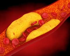 ਖਾਣਾ ਬਣਾਉਣ ਲਈ ਵਰਤੋ ਸਰ੍ਹੋਂ ਦਾ ਤੇਲ, ਦੂਰ ਹੋਣਗੀਆਂ ਆਹ 6 ਗੰਭੀਰ ਪਰੇਸ਼ਾਨੀਆਂ