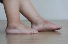 सोते समय दिखें ये 6 लक्षण तो समझ जाएं पूरी तरह खराब हो गई किडनी, तुरंत भागें डॉक्टर के पास