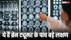 सोते समय दिखें ये 5 लक्षण तो समझ जाएं हो गया है ब्रेन ट्यूमर, तुरंत करें डॉक्टर को कॉल