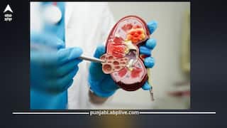 Kidney Cancer: ਕਿਡਨੀ ਕੈਂਸਰ ਦੇ 5 ਸ਼ੁਰੂਆਤੀ ਲੱਛਣ ਜੋ ਅਕਸਰ ਨਜ਼ਰ ਨਹੀਂ ਆਉਂਦੇ, ਡਾਕਟਰ ਤੋਂ ਜਾਣੋ ਕਾਰਨ, ਲੱਛਣ ਅਤੇ ਇਲਾਜ