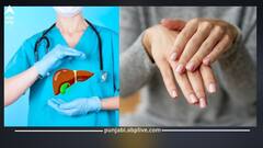 ਨਹੁੰ ਵੀ ਦੇਣ ਲੱਗ ਪੈਂਦੇ ਮਾੜੇ ਜਿਗਰ ਦੀ ਵਾਰਨਿੰਗ! ਸਿਹਤ ਵੱਲ ਫਟਾਫਟ ਦਿਓ ਧਿਆਨ