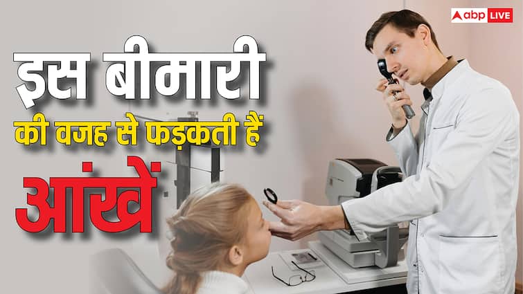 क्यों फड़कने लगती हैं आपकी आंखें, ये कोई बीमारी है या शुभ-अशुभ के संकेत? क्यों फड़कने लगती हैं आपकी आंखें, ये कोई बीमारी है या शुभ-अशुभ के संकेत?