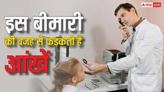 क्यों फड़कने लगती हैं आपकी आंखें, ये कोई बीमारी है या शुभ-अशुभ के संकेत?