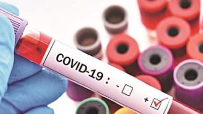 ‘Stratus’ COVID Variant Spreads Rapidly Across US, Here's What To Know About XFG Strain