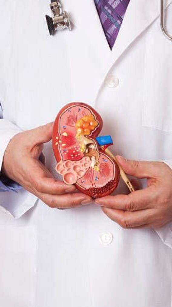 9 Simple And Natural Ways To Prevent Kidney Stones