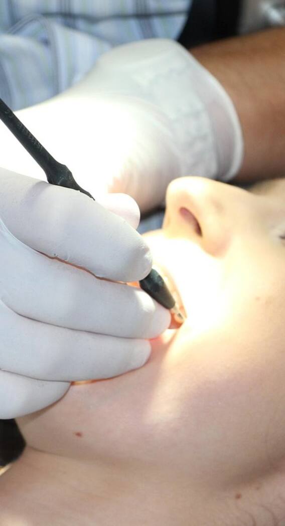 दांतों पर नींबू रगड़ने से क्या होता है फायदा?