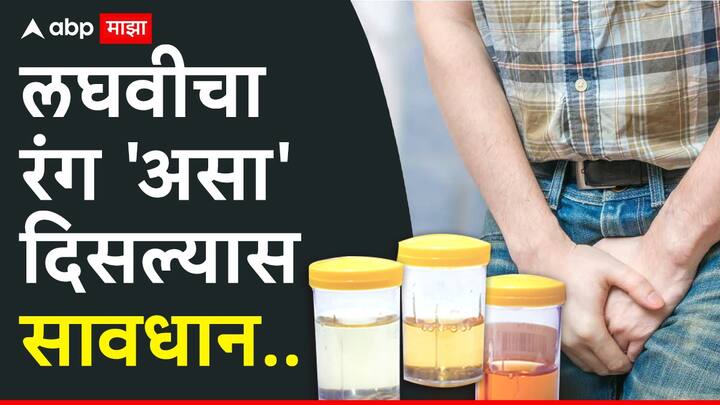 Urine Color: सामन्यापणे लघवीचा रंग हा हलक पिवळा असतो. पण जर लघवीचा रंग बदलला तर आरोग्य धोक्यात येऊ शकतं.
