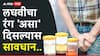 Urine Color: लघवीचा रंग 'असा' दिसल्यास सावधान; तुमच्या लघवीचा रंग सांगतो, आजारी आहात की नाही!