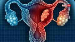 Cancer News: गर्भाशय कैंसर से पीड़ित मरीजों के साथ लापरवाही, ठीक से नहीं हो पा रही जांच- रिसर्च
