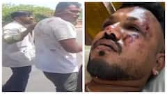 ஆயிரத்தில் ஒருவன்.. விமான விபத்தில் உயிர் தப்பிய அந்த ஒரு நபர்.. பதற்றத்துடன் நடந்து செல்லும் காட்சி 