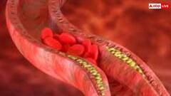 45 की उम्र के बाद ये संकेत दिखें तो हो जाएं सतर्क, हो सकता है हाई कोलेस्ट्रॉल